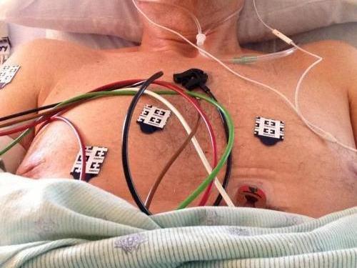 ICU